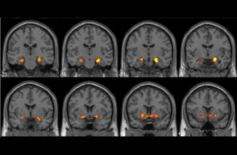 This Is What Your Mind Seems to be Like When You R...